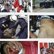 افزایش شکنجه و اهانت های مذهبی علیه زندانیان شیعه در بحرین