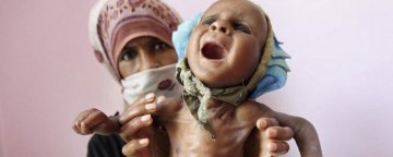 حمایت آشکار آمریکا از استراتژی قحطی و گرسنگی عربستان در یمن