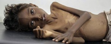افزایش بحران جهانی ناامنی غذا و تاثیرات آن در یمن