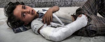 آسیب‌پذیری کودکان یمنی در برابر بیماری‌های روحی