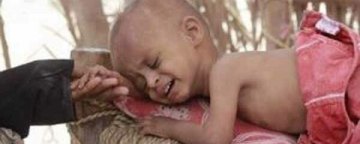 فقر و گرسنگی کودکان، ارمغان منازعه طولانی یمن