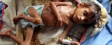 فقر و گرسنگی در یمن، بحرانی بی‌پایان