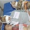  ������������-������-279-��������-����-������-����-10-��������-����������-��������-�������� - هشدار سازمان ملل به عربستان درباره جنایات هولناک علیه کودکان یمن
