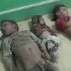  ������������-������-������������-�������������-������������-��������-����-������-���� - گزارش سازمان ملل از فاجعه کشتار کودکان یمنی توسط متجاوزان عربستانی