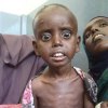  ������������-������-����-������������-��������-������������������-����-������-����������-����-������������-������-������ - بحران غذایی 6 میلیون کودک را در اتیوپی تهدید می کند