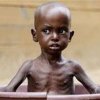  نمایش-رنج-کودکان-بیمار-ایرانی-در-سازمان-ملل-متحد - کودکان جمهوری آفریقای مرکزی از گرسنگی می میرند