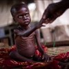  ������������������������������-������������-����������������-���������� - گسترش جهانی سوءتغذیه