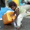  ������������-������-����-������������-����-��������-����-������-��������-��������������� - تلفات ناشی از قحطی در یمن در حال افزایش است
