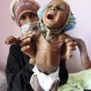  ������-����-������-��������������-����-����������-������ - فاجعه انسانی/ یمن در معرض نسل کشی