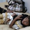  ������������-������-��������-������������-��������������-����-����-��������-��������-�������������� - کمیسیونر عالی حقوق بشر: یمن در بدترین فاجعه انسانی