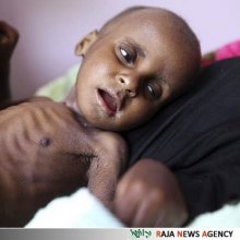 سازمان ملل: ۸۰ درصد یمنی‌ها به کمک‌های فوری غذایی نیاز دارند - کودک یمنی