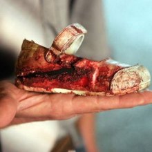 حدود پنج هزار غیرنظامی در جنگ یمن کشته شده‌اند - کودکان یمن. سایت ایرانیان
