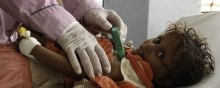  ������������������������������������-������������������ - هشدار نهادهای حقوق بشری نسبت به شرایط اسفبار کودکان یمنی