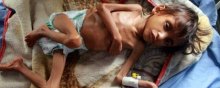 فقر و گرسنگی در یمن، بحرانی بی‌پایان - یمن